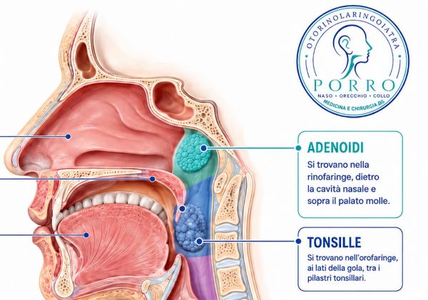 infografica posizione adenoidi e tonsille con logo otorinolaringoiatra Porro